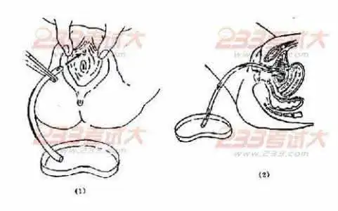 导尿管的简笔画