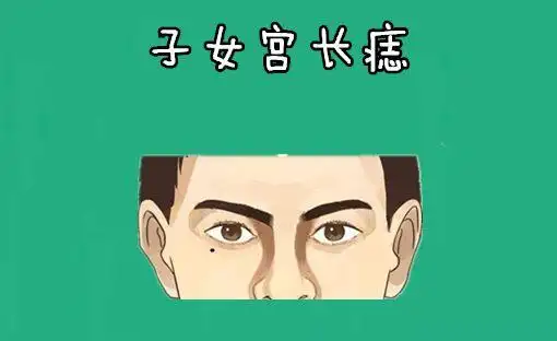 身上4颗"辛苦"痣,亲人不亲,代代吃苦,辈辈穷,打一辈子工!_网易订阅