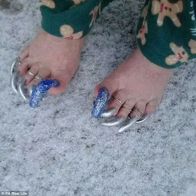 美女子患癌后辞职 靠网晒15厘米长指甲为生