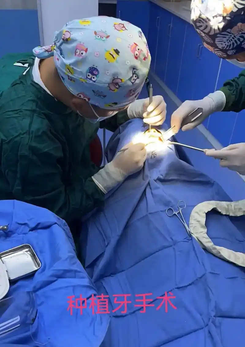 张德刚口腔:前牙种植植骨盖膜一例 - 抖音
