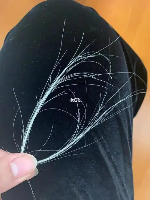 32岁两天拔了这么多白头发正常吗