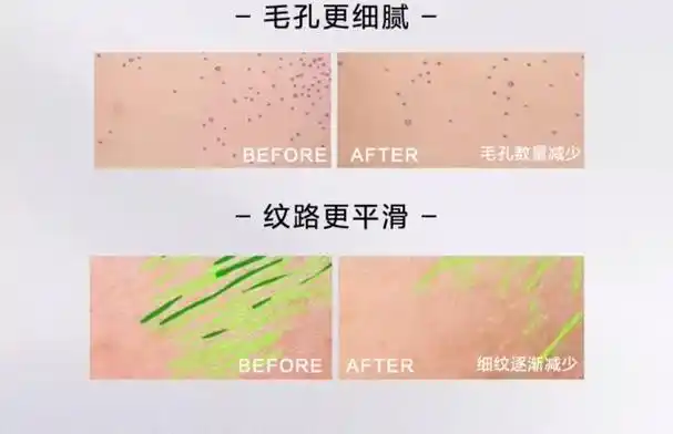 欧莱雅黑精华紧致抗老面部精华液抗皱保湿抗初老收缩毛孔护肤品女_折