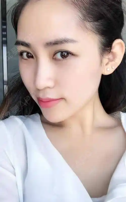 最近小脸蛋已经好 很多很多啦