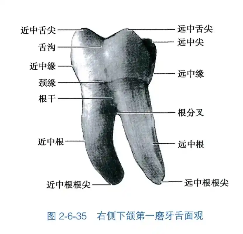 口解——下颌第一磨牙图谱.熟记该牙各个观测面解剖形态 #口腔 - 抖音