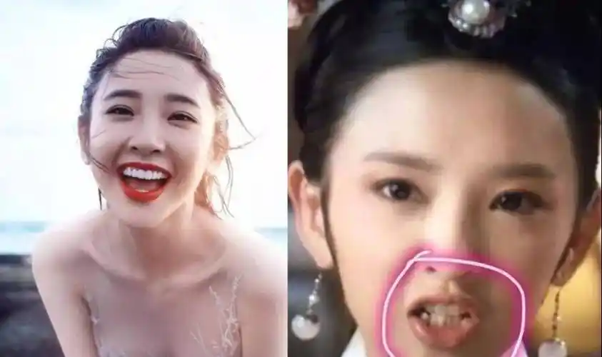明星烤瓷牙变灾难,嘴包不住牙,嘴凸,变老,演戏难看_牙齿_观众_刘涛