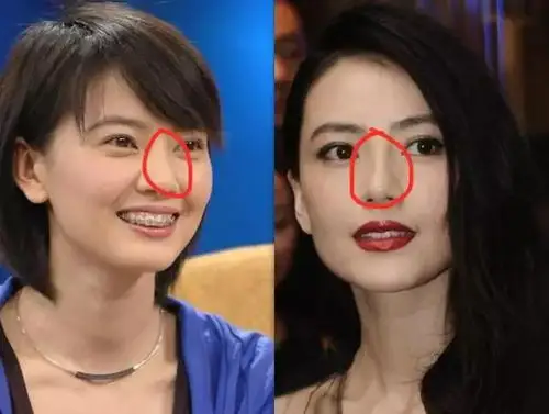 别以为这些女明星没整容 不然能比以前美这么多?