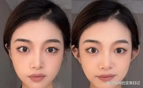 短宽脸怎么变美?来看看吧