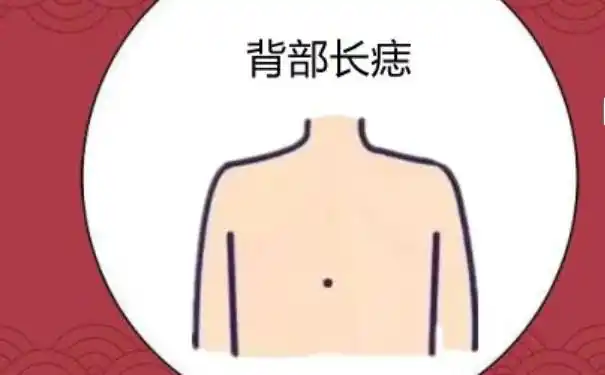 后背有痣的喻意是什么原来竟然还隐藏着这么重要的信息