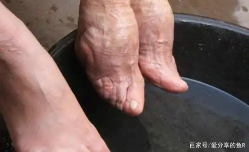 后一个小脚丫老人三寸金莲只见过她丈夫,几乎不洗脚
