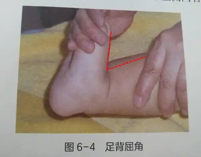 原创宝宝足尖着地,该如何区分正常和异常?父母们在这件事上可别大意