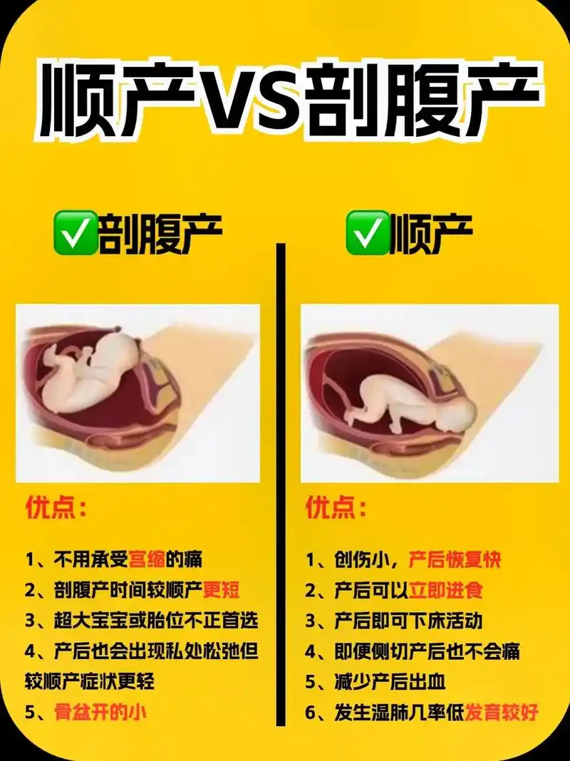 顺产与剖腹产优劣7515生孩子前先看完这篇.