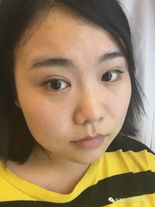 大饼脸的妹子你自卑吗拯救大饼脸塌鼻子用这个方法肯定行