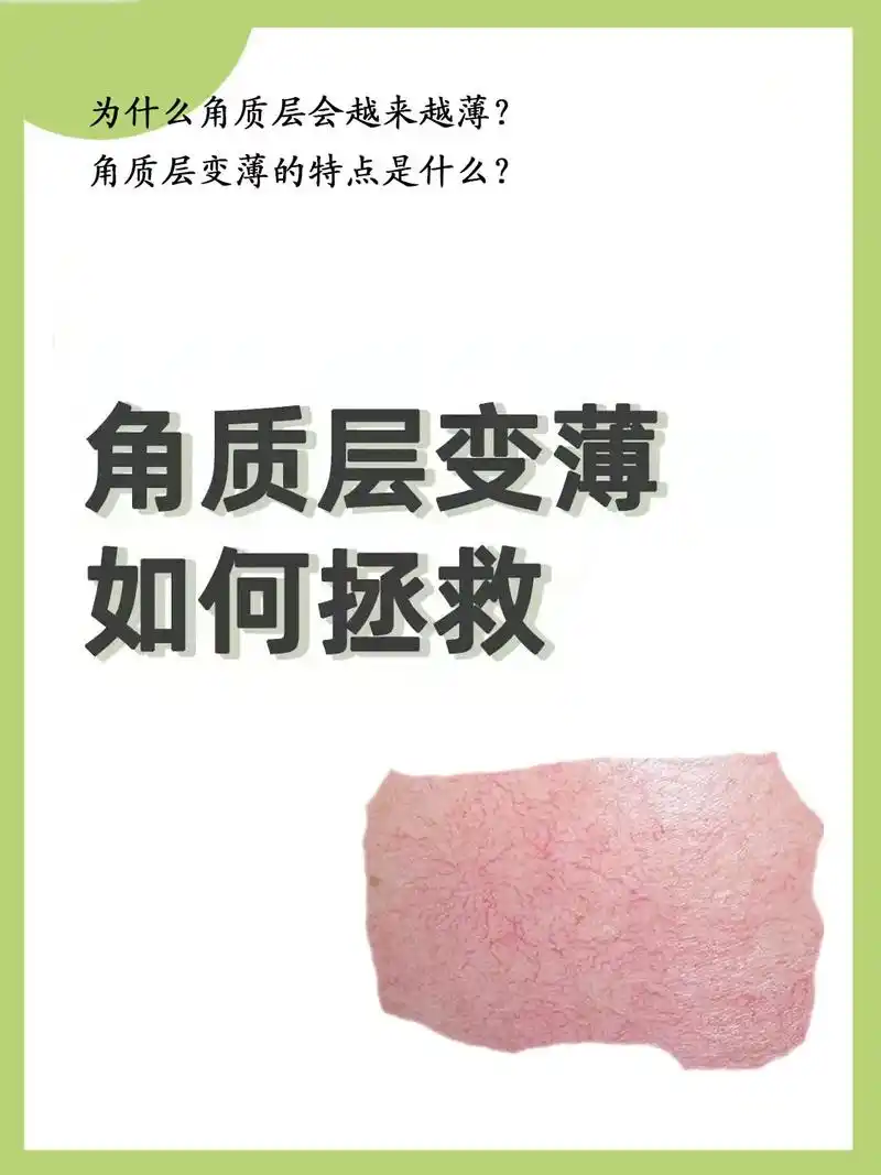 角质层薄如何修复  ①保护皮下组织以及抵抗化学和外界所带来的 - 抖