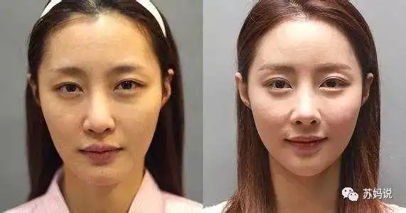 为啥刘涛苹果肌这么饱满快照照镜子看看你的苹果肌串岗了没