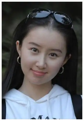 舒畅近照脸部浮肿僵硬,对比闺蜜刘亦菲的状态,谁能想到她才33岁