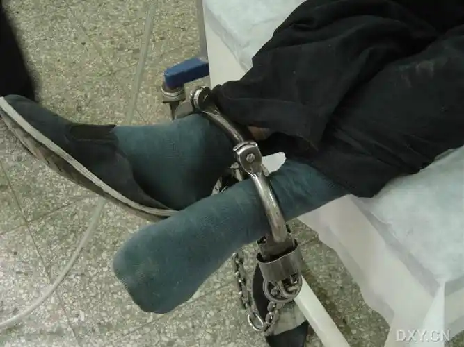 吸毒犯人无痛胃镜一例