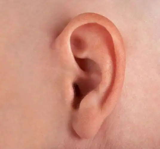 心理测试下面四只耳朵最有福气是哪只看你天生是富贵命吗