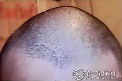 象征不忠不义之人的"反骨"到底长什么样