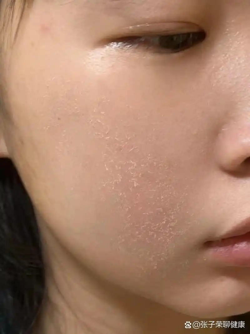 请大数据推荐给脸上脱皮的人