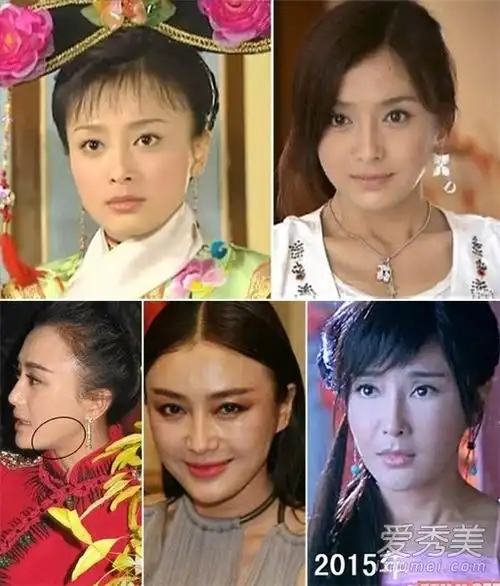 林青霞萧蔷蒋勤勤朱茵 "琼瑶女郎"容貌巨变