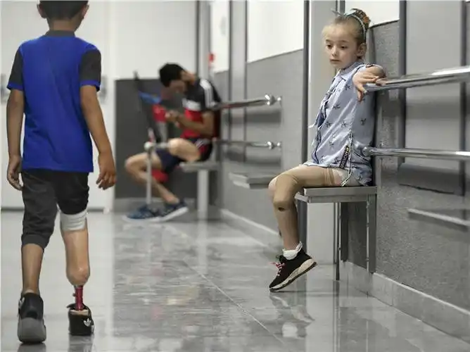 叙利亚大马士革,红新月会假肢康复中心,来自霍姆斯的9岁小女孩fatema