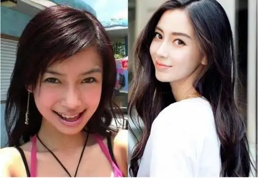 杨颖整容前(杨颖出道前"丑照"曝光)