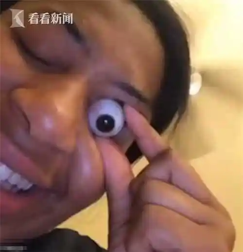 逆天奇女子徒手拉出眼珠子 还能按回