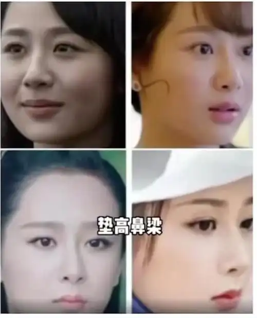 杨紫整容了吗(杨紫再次被质疑整容)