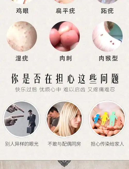 买2送1丝状疣去除颈部祛扁平疣面部脸上肉粒肉疙瘩脖子瘊子跖疣腋下克