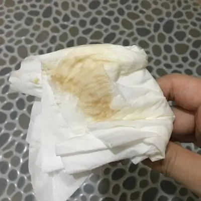 褐色的血了,不过量比之前的多了,10周的时候有去做b超说有少量出血