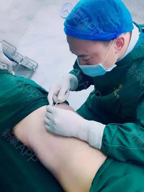 谨记大人法旨吸脂瘦腰腹第1天美丽日记