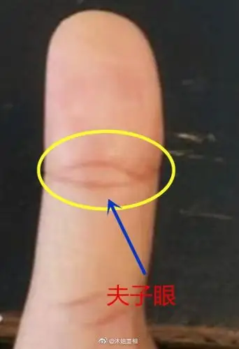 夫子眼又叫做凤眼纹,大拇指生有凤眼纹为人. 来自沐姐面相 - 微博