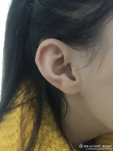 丹朱在一"棋",只有坚持,才有资格任性 -- 丹朱棋子 美美老师