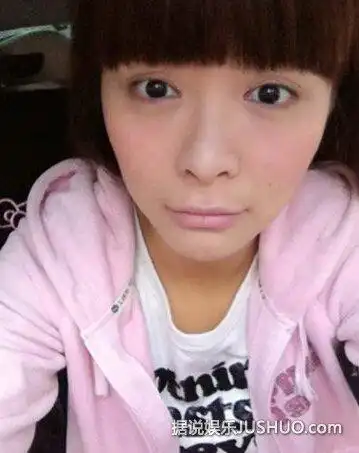 杜海涛女友沈梦辰整容前后对比照曝光