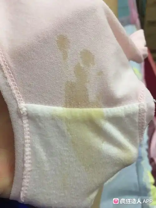 孕七周 和孕十周 ,都出现黄色分泌物流出,起初水