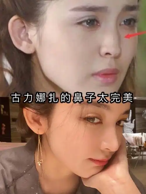 古力娜扎整完鼻子之后 整个人气质都不一样了 更高级_圈子-新氧美容