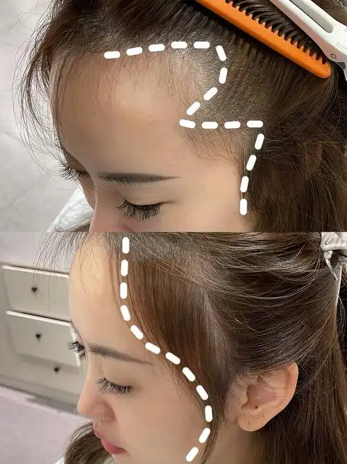 胎毛刘海 拯救高额头 脑门大 发际线后移