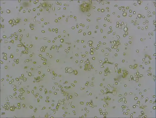 【求助】巨噬细胞油红o染色