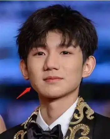 就有有王源长痘的照片流出,就已经被不少网友吐槽:太丑了