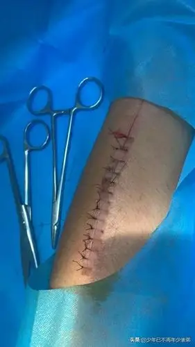 货车司机自残求复磅,当事人发声,伤口14针