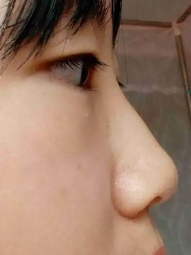 这样算塌鼻子吗,是什么鼻?