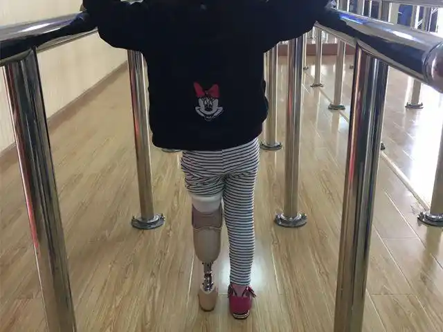 安装多久可以行走?云南晟康假肢为你解答