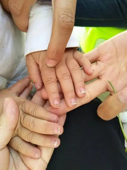 闺女今年3岁了,手指甲长成这样是咋回事儿啊,求各位懂得大神指点,下图