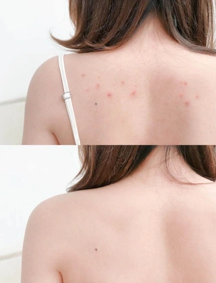 去角质死皮搓泥宝300ml