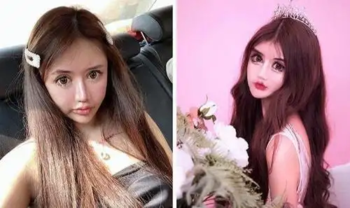 网红整容成瘾13岁起整容100次!网友:你的才艺就是脸吓人