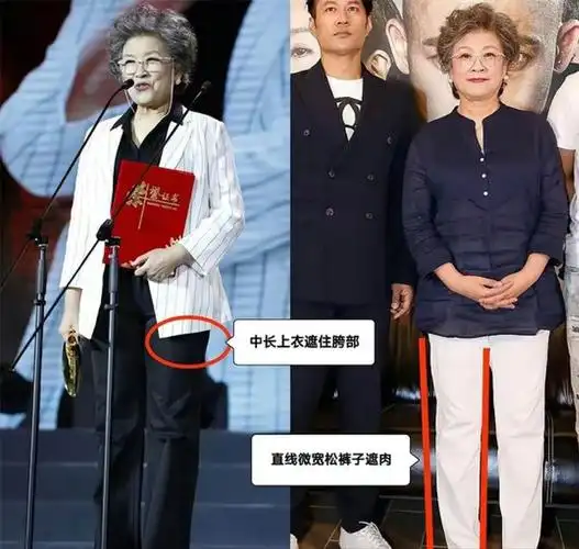 72岁宋春丽太优雅了衣穿简带丝巾白发不染年轻态十足