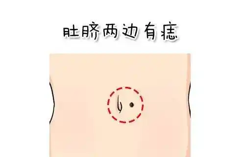 肚脐左右有痣代表爱情坚厚,无论有多大的变故都不会和心爱的人分开总