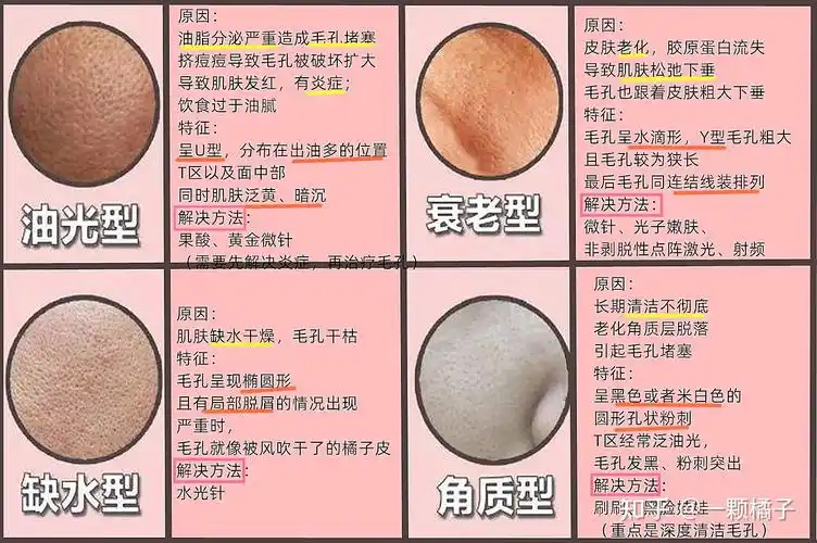 毛孔粗大单靠护肤品是解决不了的  还是得靠它们