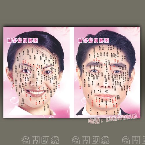 面部痣细解图无框画美容院海报壁画装饰画 男女痣图挂画墙画图片