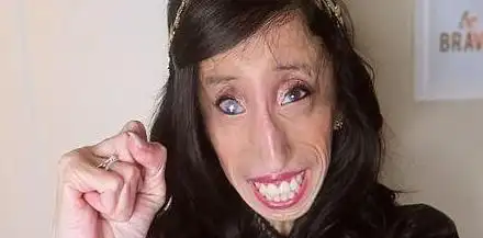 世界上最丑陋的人62岁的安妮伍兹面部表情丑哭你